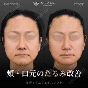 Otus Clinic 【オータスクリニック】 中 徳太郎医師の症例