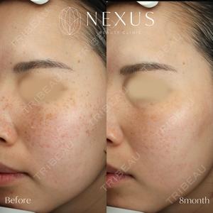 NEXUS CLINICの症例