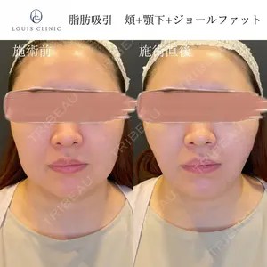 LOUIS CLINIC 二子玉川院【ルイクリニック】 小松 塁医師の症例