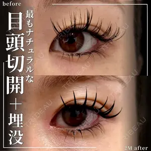 グローバルビューティークリニック 大阪院の症例