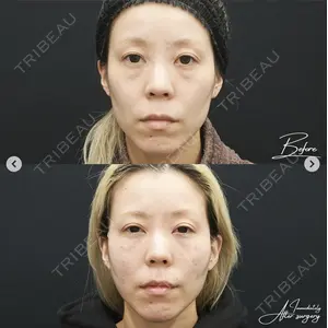 湘南美容クリニック 銀座院の症例