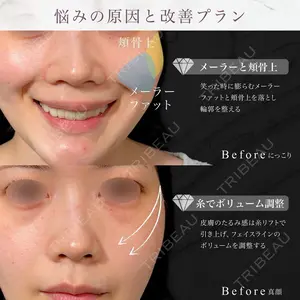東京シンデレラ美容外科 池袋院の症例