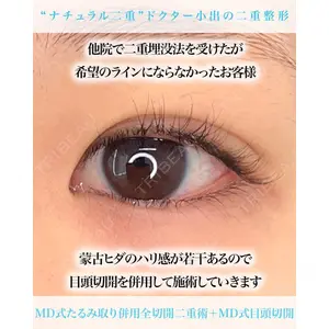 東京シンデレラ美容外科 池袋院 小出 真哉医師の症例