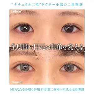 東京シンデレラ美容外科 池袋院 小出 真哉医師の症例