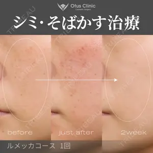Otus Clinic 【オータスクリニック】 中 徳太郎医師の症例