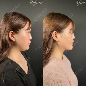 R Beauty CLINIC 名古屋院 木村 尚大医師の症例