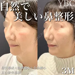 YBC横浜美容外科 大宮院 磯村 亮輔医師の症例