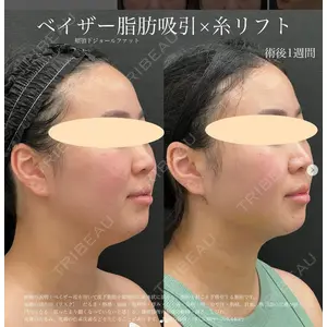 湘南美容クリニック 名古屋駅本院 豊嶋 沙良医師の症例