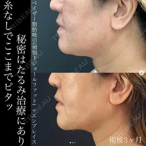 湘南美容クリニック 名古屋駅本院 豊嶋 沙良医師の症例