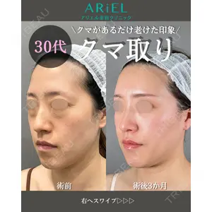 アリエル美容クリニック 大宮院 鈴木　桂介医師の症例