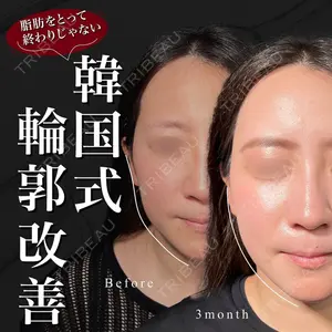東京シンデレラ美容外科 池袋院の症例
