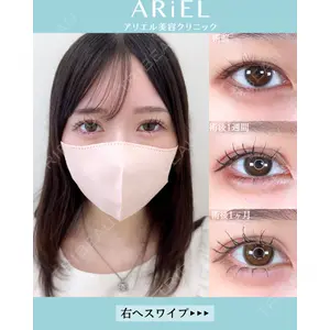 アリエル美容クリニック 大宮院の症例