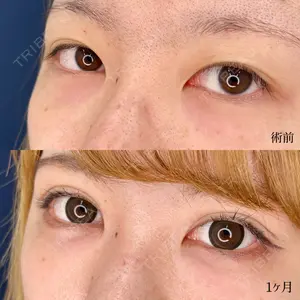 東京シンデレラ美容外科 大宮院の症例