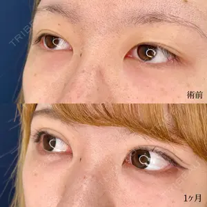 東京シンデレラ美容外科 大宮院の症例