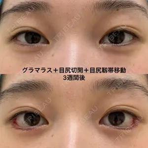 エターナル美容クリニック 久門田 詳医師の症例