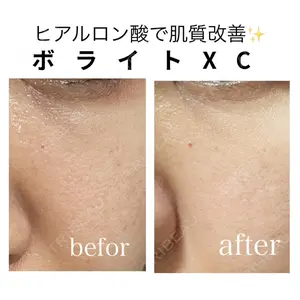 椿クリニック 名古屋院の症例