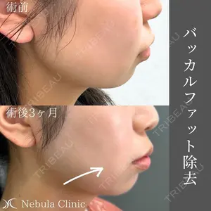 ネビュラクリニック 広島院 穴井　元康医師の症例