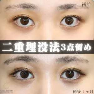 東京ココセランクリニック 篠﨑 智公医師の症例