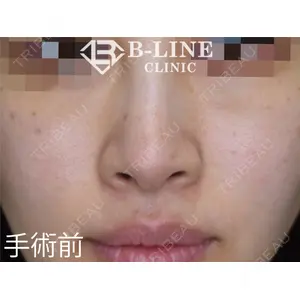 B-LINE CLINIC 池袋院 小池 康弘医師の症例
