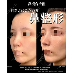 グローバルビューティークリニック 大阪院の症例