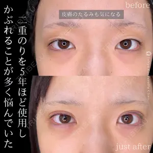 東京シンデレラ美容外科 新宿院 土門 一迅医師の症例