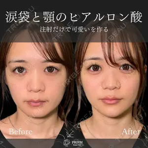 PRISM Beauty Clinic 畑山 知輝医師の症例