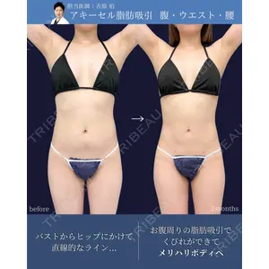 東京シンデレラ美容外科 新宿院 吉原 伯医師の症例