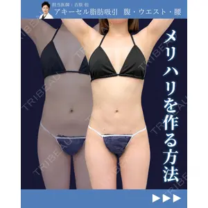 東京シンデレラ美容外科 新宿院 吉原 伯医師の症例