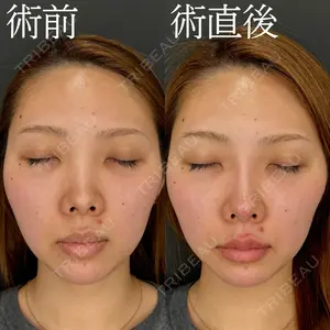 HAAB×DREAM BEAUTY CLINIC 大阪梅田院 柏木 太雅医師の症例
