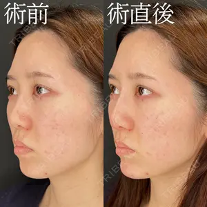 HAAB×DREAM BEAUTY CLINIC 大阪梅田院 柏木 太雅医師の症例