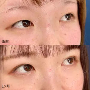 東京シンデレラ美容外科 大宮院の症例