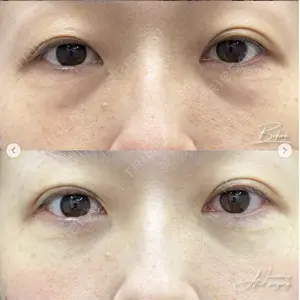 湘南美容クリニック 銀座院の症例