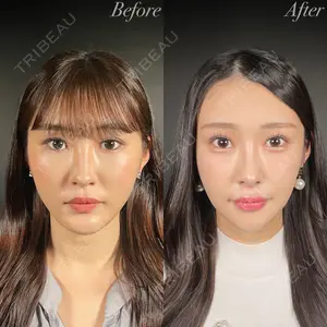 R Beauty CLINIC 銀座院 吉田　慧医師の症例