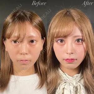 R Beauty CLINIC 銀座院 吉田　慧医師の症例