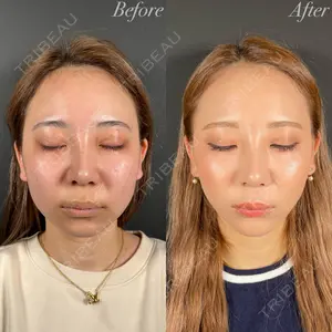 R Beauty CLINIC 名古屋院 木村 尚大医師の症例