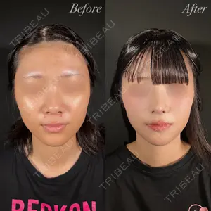 R Beauty CLINIC 大阪院 小池 泰弘医師の症例