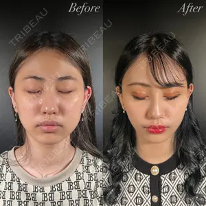 R Beauty CLINIC 大阪院 小池 泰弘医師の症例
