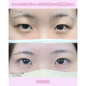 湘南美容クリニック 名古屋院 山本 高士医師の症例