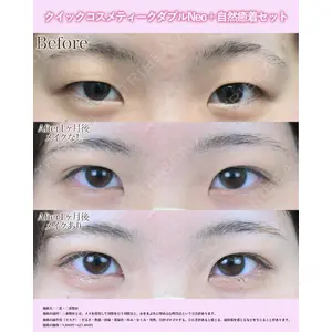 湘南美容クリニック 名古屋院 山本 高士医師の症例