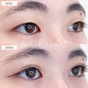 A CLINIC（エークリニック） 福岡院 小林 直樹医師の症例
