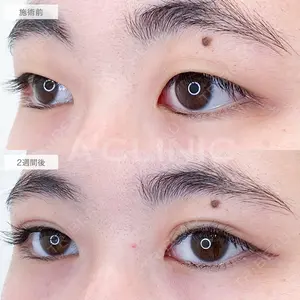 A CLINIC（エークリニック） 福岡院 小林 直樹医師の症例