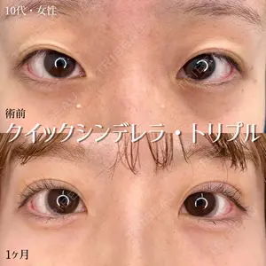 東京シンデレラ美容外科 大宮院の症例