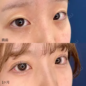 東京シンデレラ美容外科 大宮院の症例