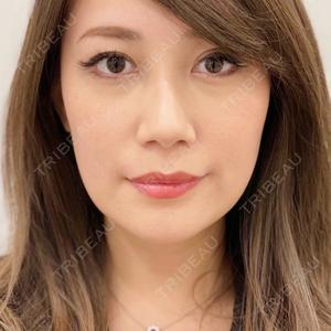 A CLINIC（エークリニック） 新宿院 山田 哲雄医師の症例