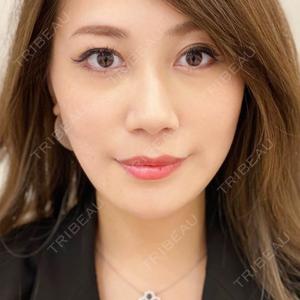 A CLINIC（エークリニック） 新宿院 山田 哲雄医師の症例