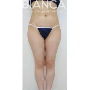 BIANCA銀座 堀田 和亮医師の症例