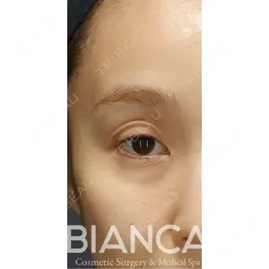 BIANCA銀座 堀田 和亮医師の症例