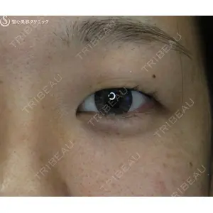 聖心美容クリニック 名古屋院 加藤 大典医師の症例