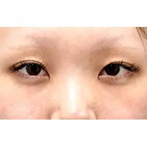もとび美容外科クリニック 新宿院 西尾 謙三郎医師の症例