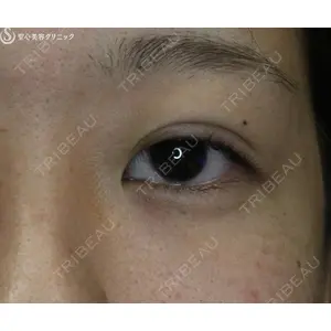 聖心美容クリニック 名古屋院 加藤 大典医師の症例
